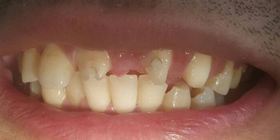 دندان پزشکی در باقرشهر