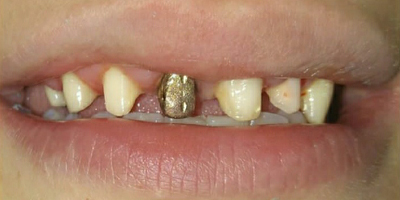 دندان پزشک در محدوده باقرشهر- درمان زیبایی